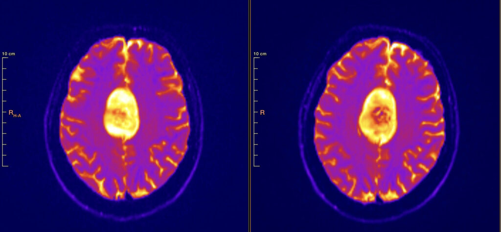 image of a brain scan